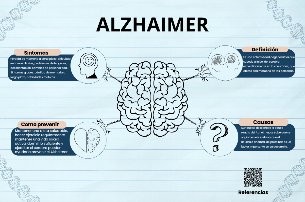 Infografía Alzheimer